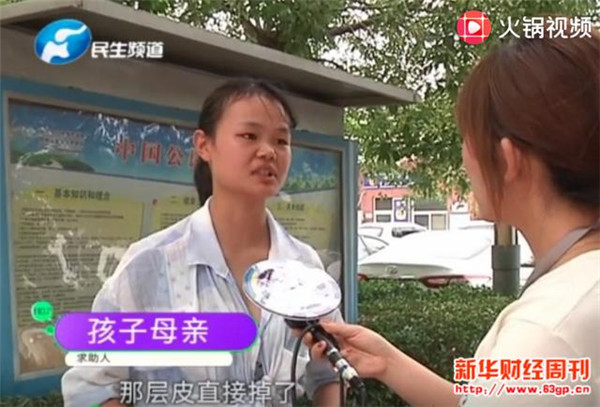 郑州西刘庄村卫生所膏药烧烂幼童肚皮 药是亚宝药业提供