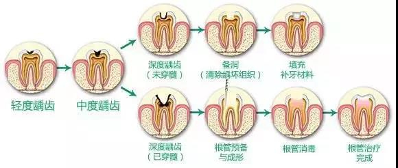 牙医最怕“第三者”你知道吗？