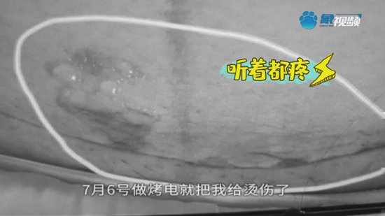 郑州雅月传承月子会所：女子花三万做产后修复，伤口没愈合反被烫出水泡！