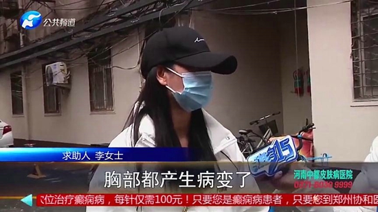 女子在郑州集美整形医院隆胸后假体移位、无知觉，面临切除风险医院：跟个人体质有关