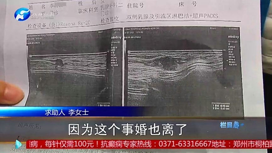 女子在郑州集美整形医院隆胸后假体移位、无知觉，面临切除风险医院：跟个人体质有关