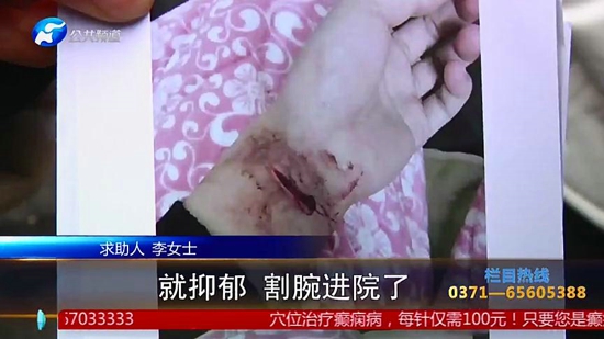 女子在郑州集美整形医院隆胸后假体移位、无知觉，面临切除风险医院：跟个人体质有关