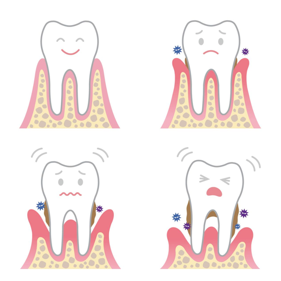 植得口腔医生提醒：警惕牙周病——牙齿的“沉默杀手”！