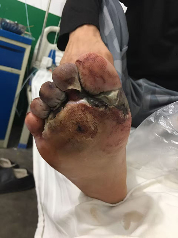 ac4c6d13e5bac385e3707e1a448837de