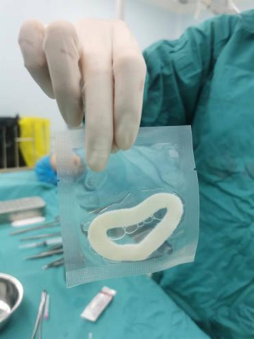 私密松弛别隐忍！科学分级应对，昆明杰西艾私密整形为你重塑私密健康