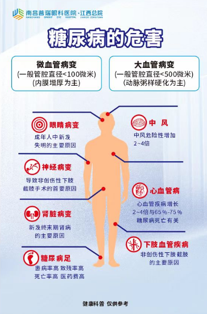 春节后别大意!三级眼科南昌普瑞眼科提醒:糖尿病眼病需警惕