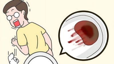 青海东大“揪出”便血背后的“真凶”！