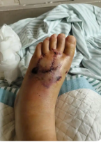 南阳瑞和医院评价咋样呀？伤口不愈合、术后伤口流水？南阳瑞和医院中西医结合，精准护愈不留疤